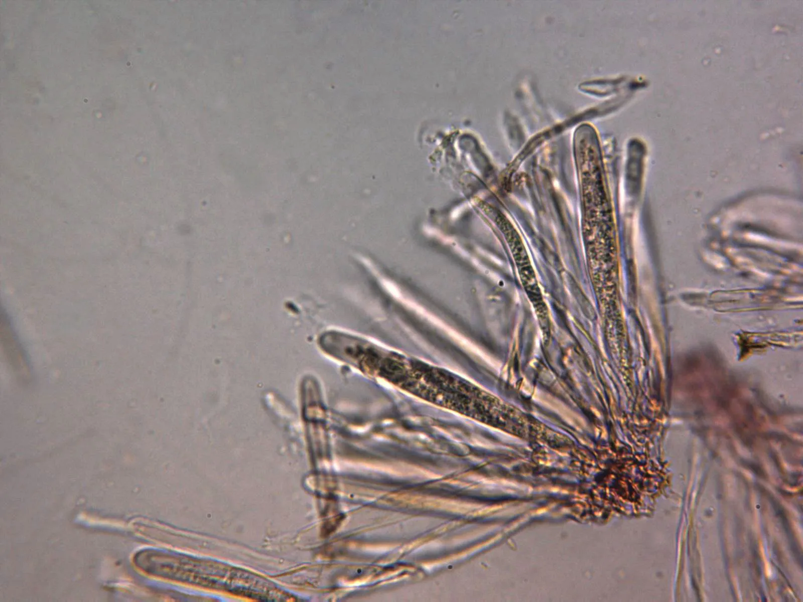 Microscopía de Peltigera polydactylon - 10 ascos x 400